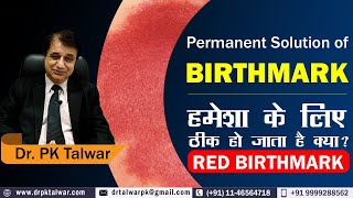 क्या हमेशा के लिए ठीक होते है Red Birthmark by Pulsed Dye Laser Treatment  Dr PK Talwar [upl. by Billmyre856]