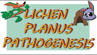 LICHEN PLANUS  Etiology amp pathogenesis [upl. by Ynatsed451]