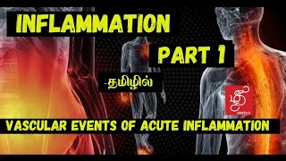 Home remedies for urine problemurine infection symptoms in tamilurine infection tamilurineproblem [upl. by Yme653]