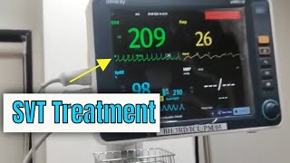 Adenosine in Supraventricular tachycardia SVT How to administer and how it works [upl. by Atsyrc]