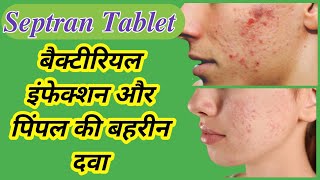 Septran DS Tablet Uses in Hindi  Septran DS  Treatment of pimples [upl. by Parrie]