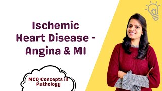 Ischemic Heart Disease  Angina amp Myocardial Infarction  MCQ concepts [upl. by Malarkey989]