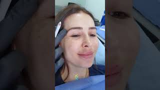 COMO QUITAR LAS ARRUGAS DE LA CARA  RECOMENDACIONES  BOTOX  TRATAMIENTOS FACIALES  PLASMA [upl. by Rentsch]