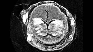 MicroCT scan crosssections of Hermodice carunculata Polychaeta Amphinomidae [upl. by Ardnassac645]