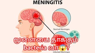 Meningitis brain disease Tamil explanation [upl. by Minica372]