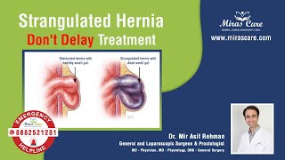 Strangulated Hernia  Dont Delay Treatment  Dr Mir Asif Rehman DNB  General Surgery Mirascare [upl. by Akiv945]