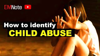 CHILD ABUSE Physical Signs [upl. by Effie]