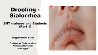 Drooling Sialorrhea ENT trainees and Students Part 1 [upl. by Llerdnek]