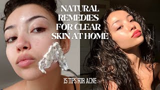 HOW TO MAINTAIN CLEAR SKIN WITHOUT SPENDING MONEY  15 tips and tricks for acne [upl. by Adnat]