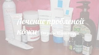 Лечение проблемной кожи Отзывы Юлии тедди [upl. by Luce]