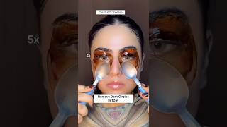 Remove Dark Circles Naturally At Home In 1DayUnderEye Dark Circles Remove Homeremedy dark shorts [upl. by Lemmy869]