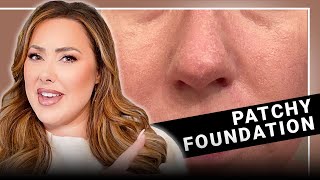 7 Reasons Why Your Foundation Looks PATCHY Tiktok didnt teach you these [upl. by Ttehr]