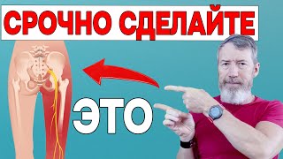 Защемило Седалищный Нерв Срочно СДЕЛАЙТЕ эти 5 Упражнений и БОЛЬ пройдет [upl. by Ilat]