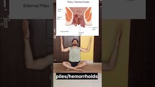 yoga for hemorrhoids yoga piles hemorrhoids shorts short viralvideo ytshortsindia ytviral [upl. by Birkett]