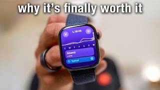 Apple Watch Series 10 Review why its finally worth it [upl. by Innej]