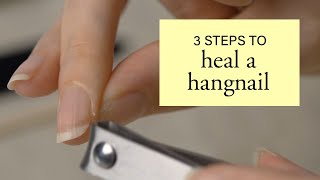 3 Steps to Heal a Hangnail [upl. by Blackmun]