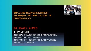 3 Exploring Neurointervention Techniques and Applications in Neuroradiology  NRSP [upl. by Melak]