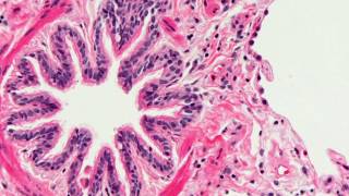 Introduction to Histopathology [upl. by Eural409]