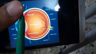 BACTERIAL CORNEAL ULCER made simple part 6 Complications of ulcer verry important [upl. by Gladstone]