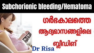 Subchorionic Hematoma  Early Pregnancy Bleeding Malayalam [upl. by Etyak290]