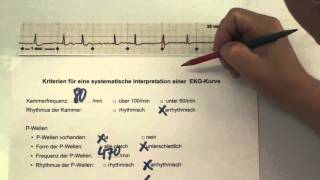 EKG für Pflege Teil 21  Vorhofflimmern interpretieren [upl. by Gustav674]