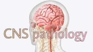 CNS pathology 1st lecture [upl. by Trula]