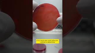 Agar sangue e macconkey [upl. by Adnwahsat894]