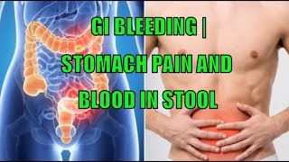 GI Bleed  Stomach Pain and Blood in Stool [upl. by Corin459]