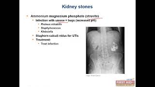 Kidney stones or Nephrolithiasis Renal pathology video part4 from USMLE First Aid Step One [upl. by Aivan]