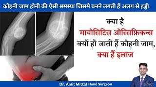 कोहनी जाम या कोहनी में अतिरक्त हड्डी का बना जानिये कारण और इलाज  myositis ossificans in the elbow [upl. by Luo]