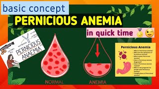 Pernicious anemia  what is anemia  cause  symptoms  treatment [upl. by Dlanar]