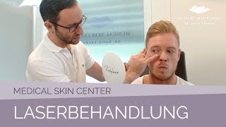 Laserbehandlung im Medical Skin Center – Dr Bacman [upl. by Giuliana96]