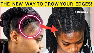 If you cant grow your edges this diy hair growth oil is for you naturalhair 4chair hairgrowth [upl. by Unity]