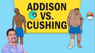 Addisons vs Cushings Disease for NCLEX RN [upl. by Marden]