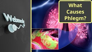 What Causes Constant Phlegm Mucus in Throat [upl. by Dlared153]