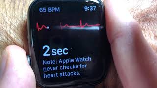 How to use Apples ECG App on the Apple Watch and Phone [upl. by Orvah43]