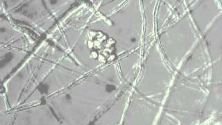 Pythium zoospore discharge [upl. by Letsirhc]