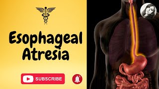 Esophageal atresia amp tracheoesophageal fistula causes types symptoms diagnosis amp treatment [upl. by Carole]