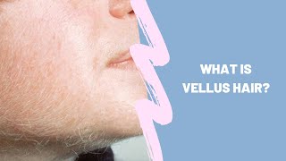 What is vellus hair [upl. by Jarus]