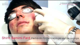 AKNE LIVEBEHANDLUNG  Isolaz und Fraxel Laser  DERMA LOFT Gladbeck [upl. by Venezia]