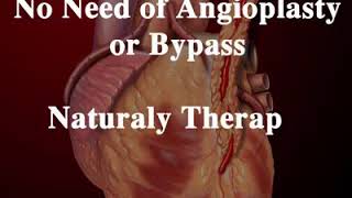 How to clear artery blockage naturally [upl. by Rhpotsirhc]