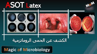 الكشف عن الميكروب السبحى والحمى الروماتزمية ASOT Test [upl. by Shannan]