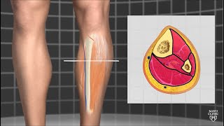 Mayo Clinic Orthopedics and Sports Medicine Chronic Exertional Compartment Syndrome [upl. by Ardnuahc]