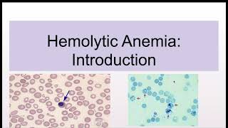 Hemolytic Anemias Introduction and Classification [upl. by Candless154]