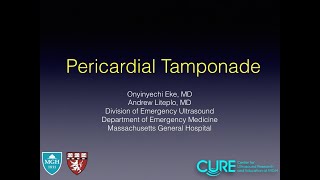 Pericardial Tamponade [upl. by Venable722]