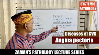 Systemic Pathology Lecture 34  Diseases of CVS  Day 04  Angina pectoris [upl. by Eimile]