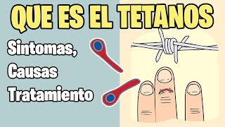 TETANOS Síntomas Clostridium Tetani  BIEN EXPLICADO [upl. by Sokram139]