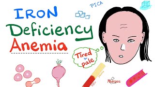 Iron Deficiency Anaemia  Etiology  Stages  Treatment by Dr Priyanka Sachdev  Medlive [upl. by Olwena]