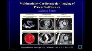 Multimodality Cardiovascular Imaging of Patients with Pericardial Disease [upl. by Xam]