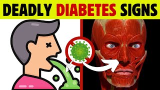 7 DEADLY SIGNS of DIABETES You Cant Ignore [upl. by Joselow]